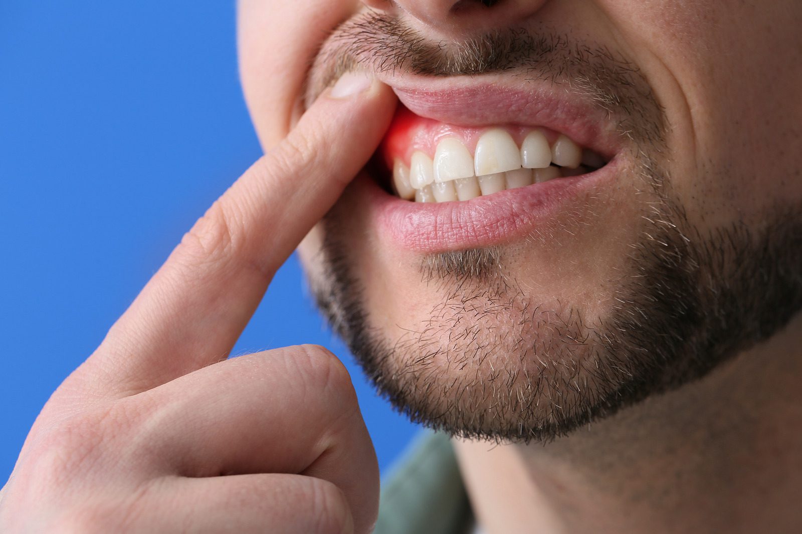 Why Are My Upper Gums Throbbing: What's Really Going On in Your Mouth?
